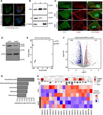 Actin cytoskeleton depolymerization increases matrix metalloproteinase gene expression in breast cancer cells by promoting translocation of cysteine-rich protein 2 to the nucleus